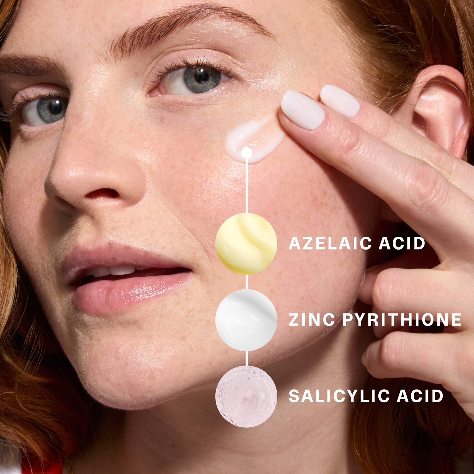 Woman with Curology active ingredients like azelaic acid